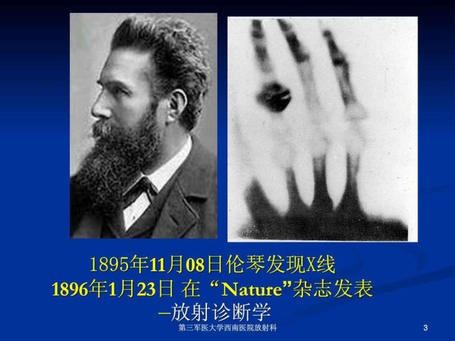 1影像诊断学总论.ppt_第3页