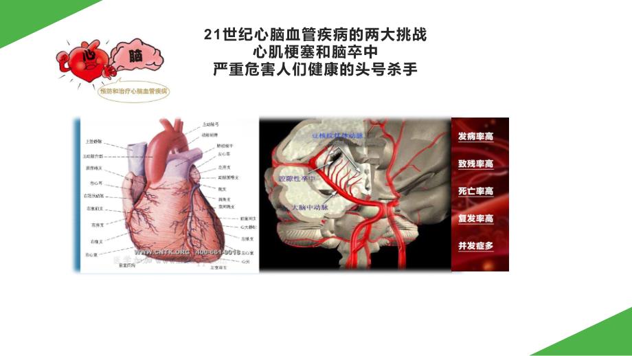 预防突发心脑血管事件健康讲座.ppt_第4页