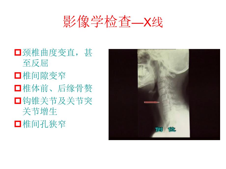 颈椎病的诊断与治疗_第1页