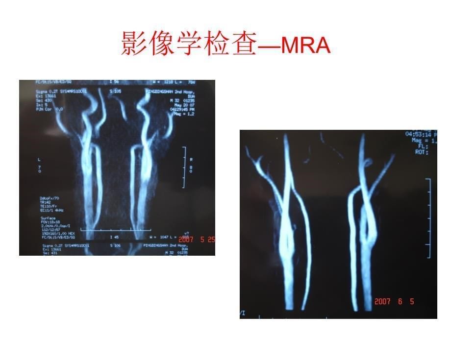 颈椎病的诊断与治疗_第5页