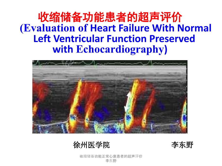 收缩储备功能正常心衰患者的超声评价李东野课件_第1页