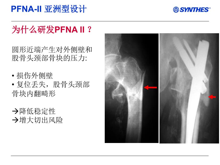 pfnaiichineseppt课件_第4页