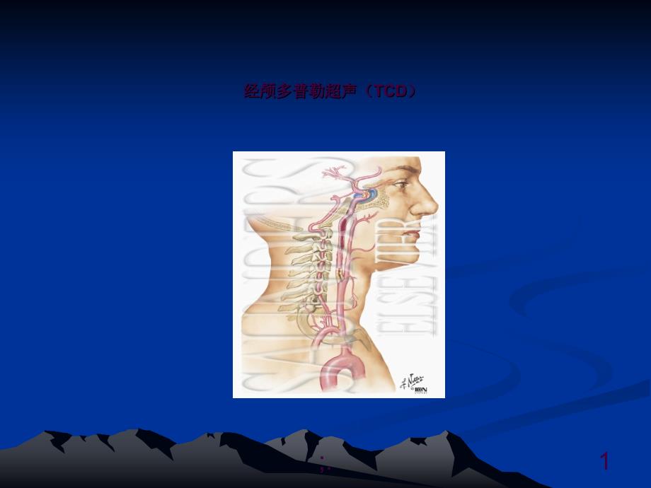 经颅多普勒TCD讲解ppt课件_第1页