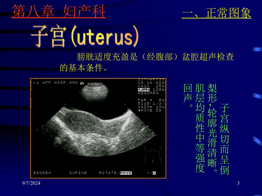 妇产科超声诊断_第3页