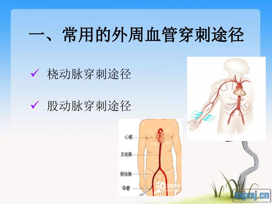 冠脉介入术后护理要点文档资料_第1页