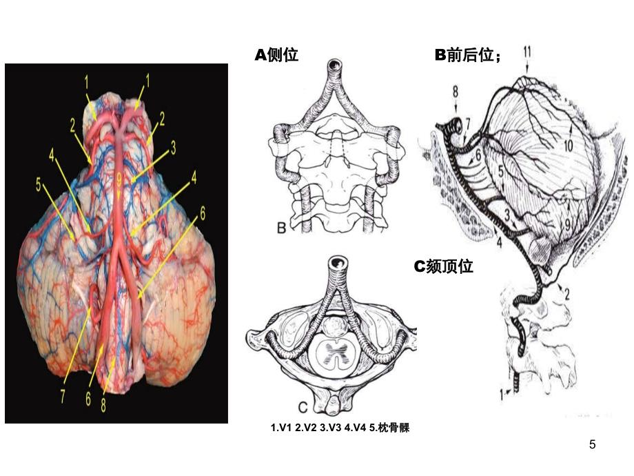 脑部血管解剖图解影像学PPT课件_第5页