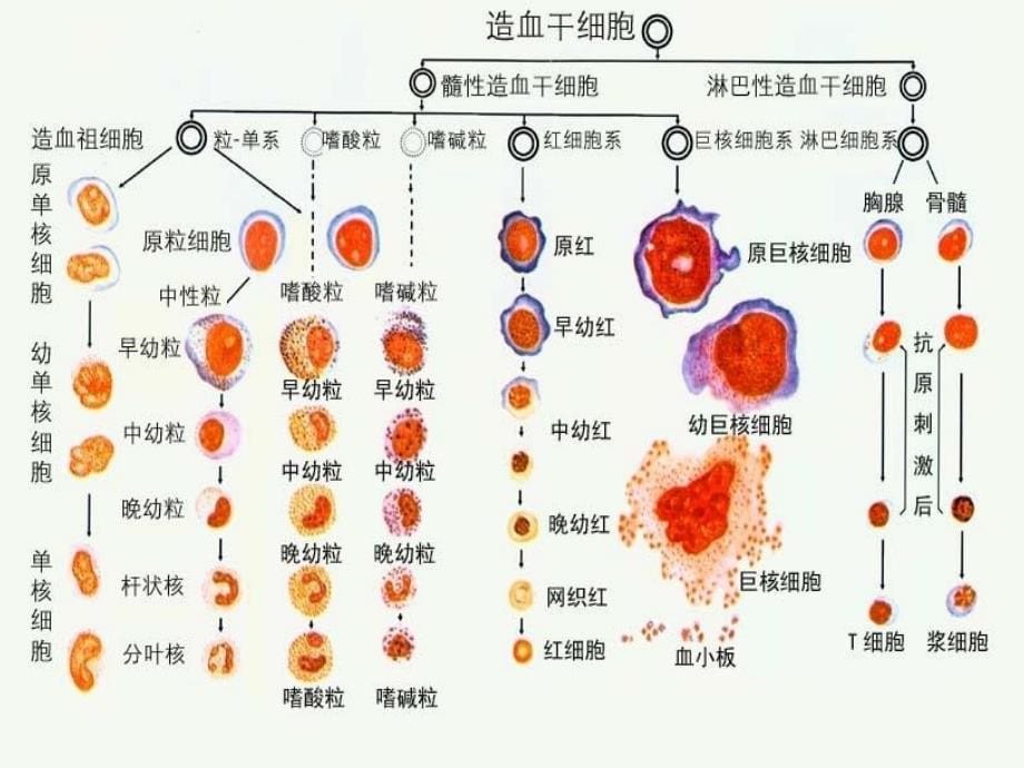 白血病病人的护理课件_第5页