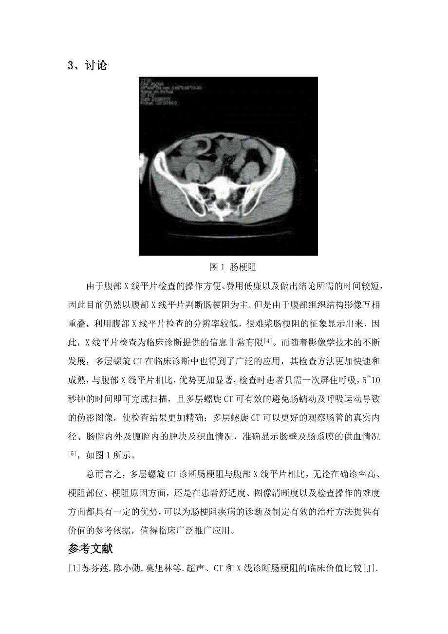 多层螺旋CT、腹部X线平片在诊断肠梗阻中的临床价值比较分析_第4页