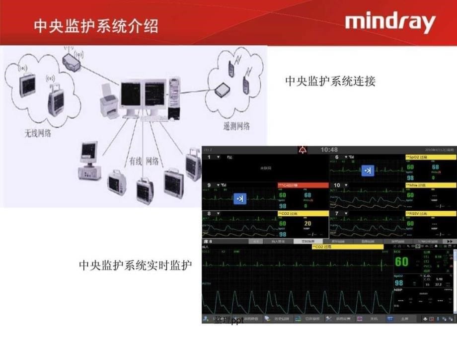 中央监护系统培训_第5页