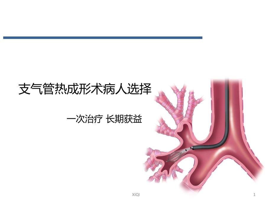 支气管热成形术的患者选择-通用版_第1页