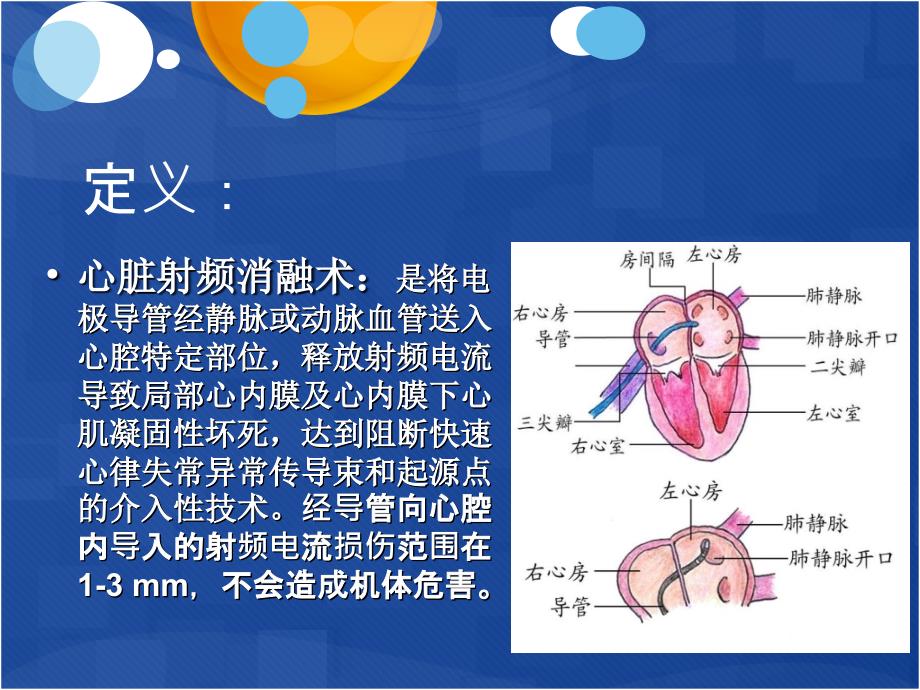 射频消融术术后护理_第2页