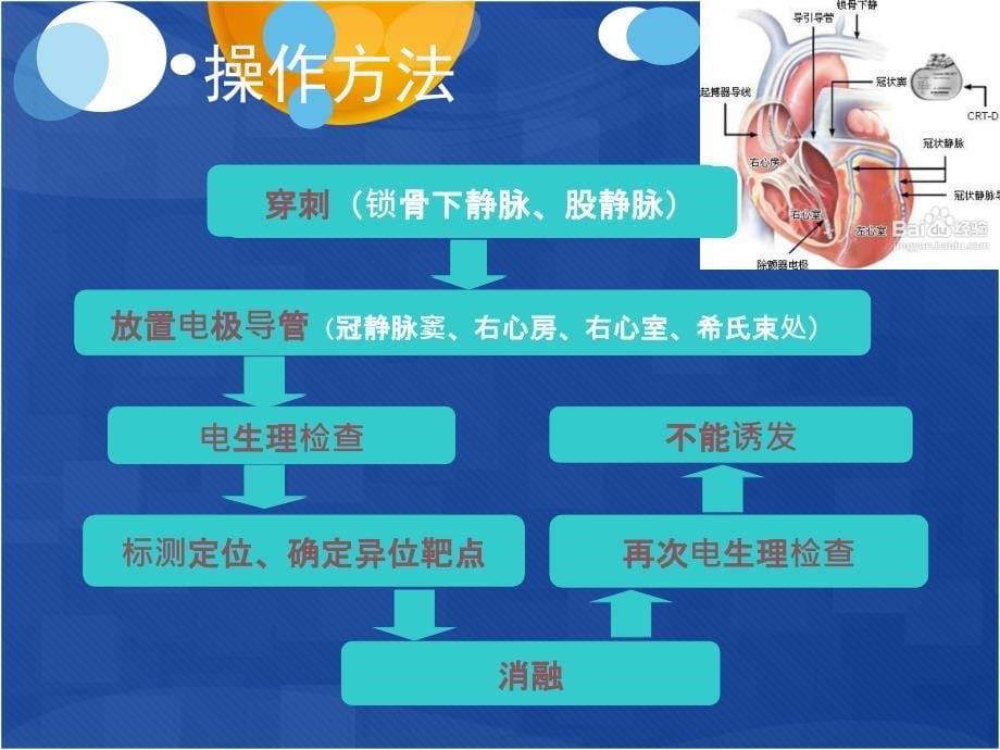 射频消融术术后护理_第5页