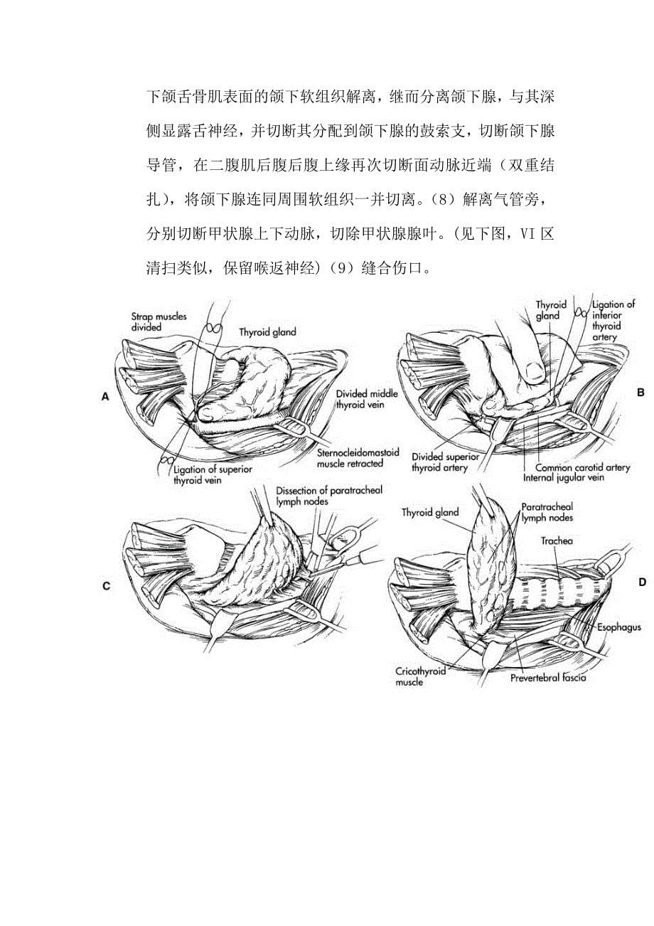 颈清图解步骤.doc_第5页