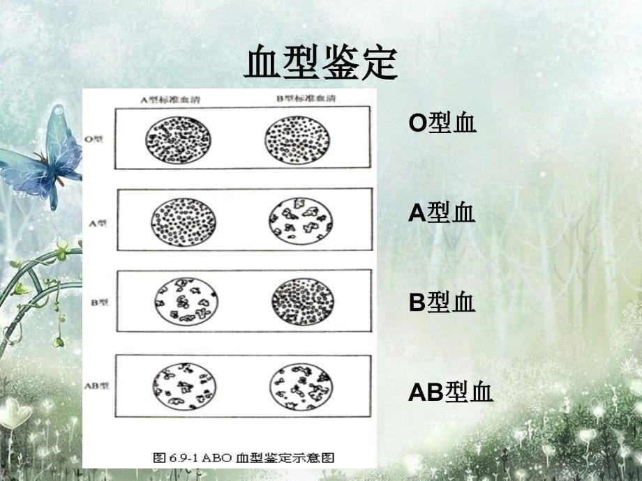 七年级下册生物输血与血型_第5页