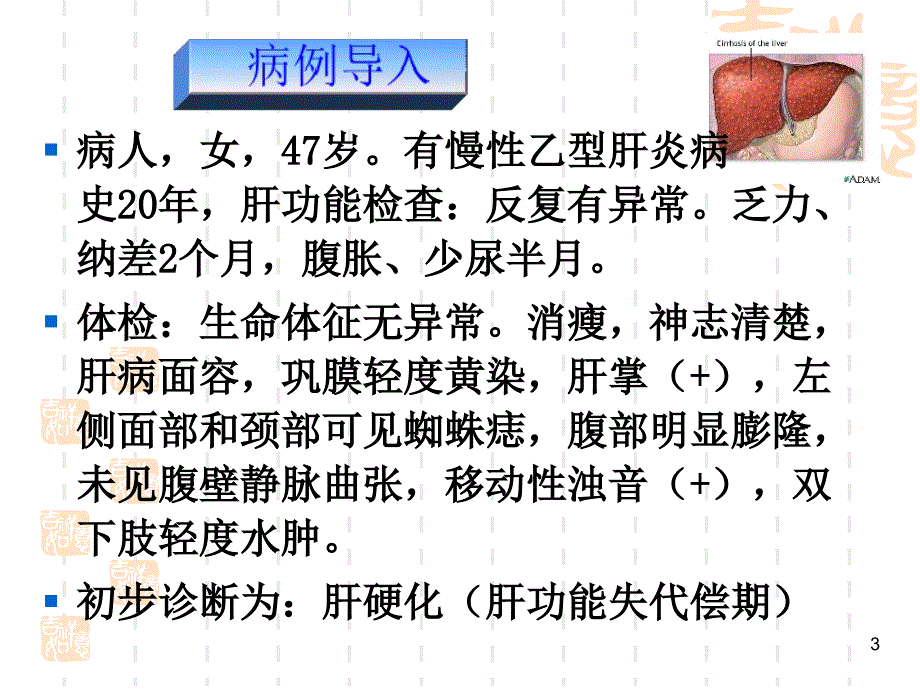 内科护理学肝硬化病人的护理PPT课件_第3页