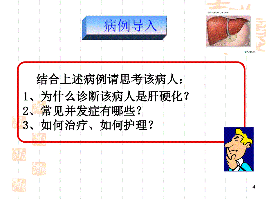 内科护理学肝硬化病人的护理PPT课件_第4页