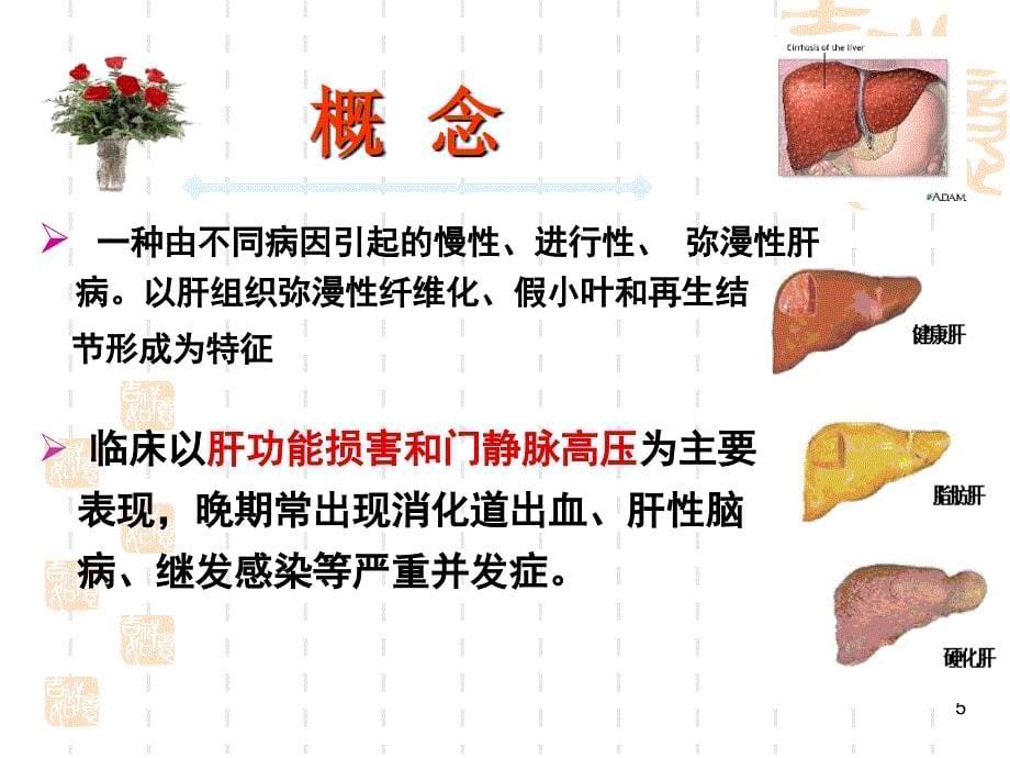 内科护理学肝硬化病人的护理PPT课件_第5页