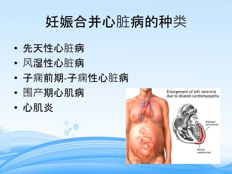 妊娠合并心脏病许雅_第4页