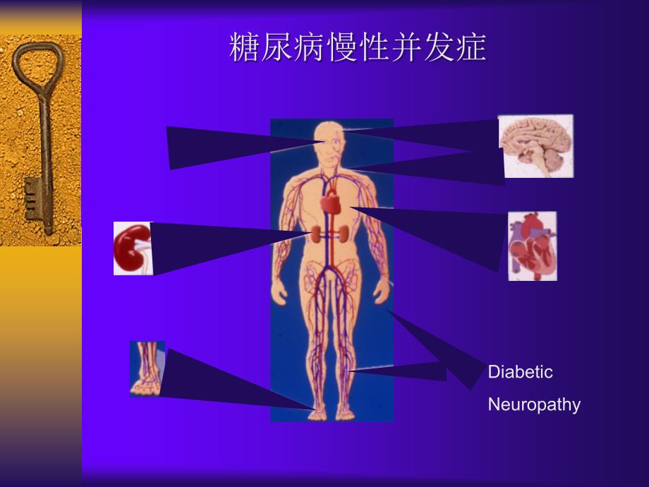 糖尿病并发症2课件_第3页