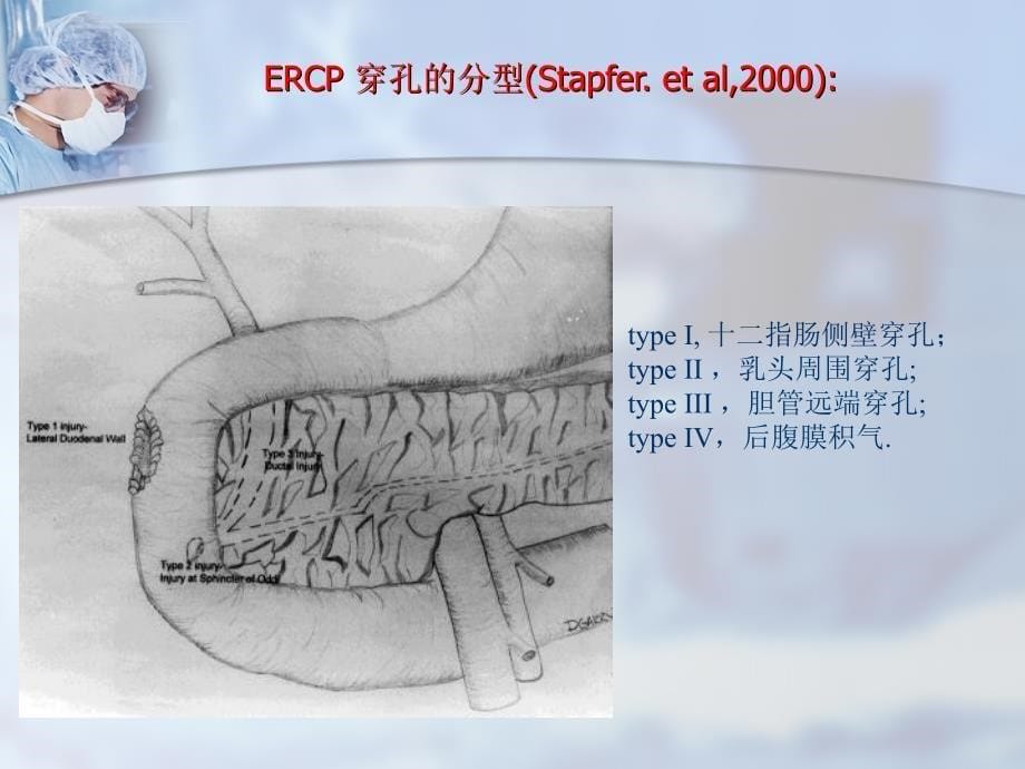 ERCP术后并发症的观察和处理_第5页