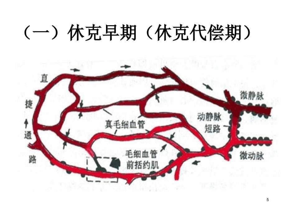 各型休克的发病机制及临床表现课件_第5页