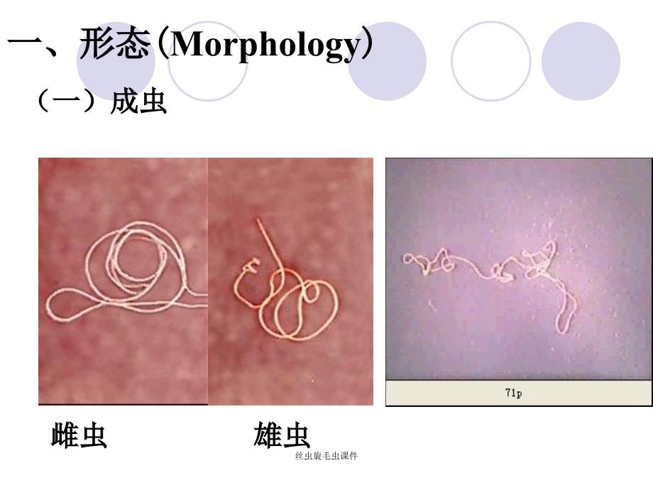 丝虫旋毛虫课件_第3页