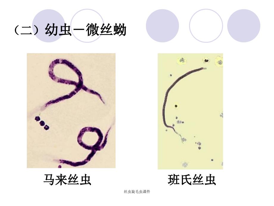 丝虫旋毛虫课件_第4页