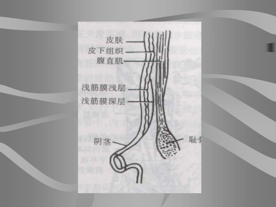 外科手术腹壁切口课件_第4页