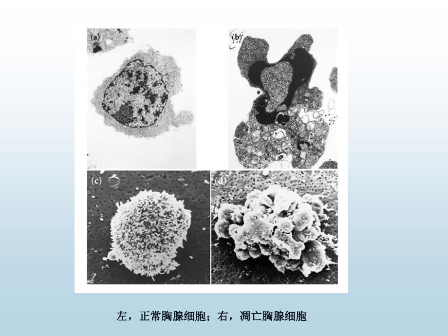 进展细胞死亡课件_第4页