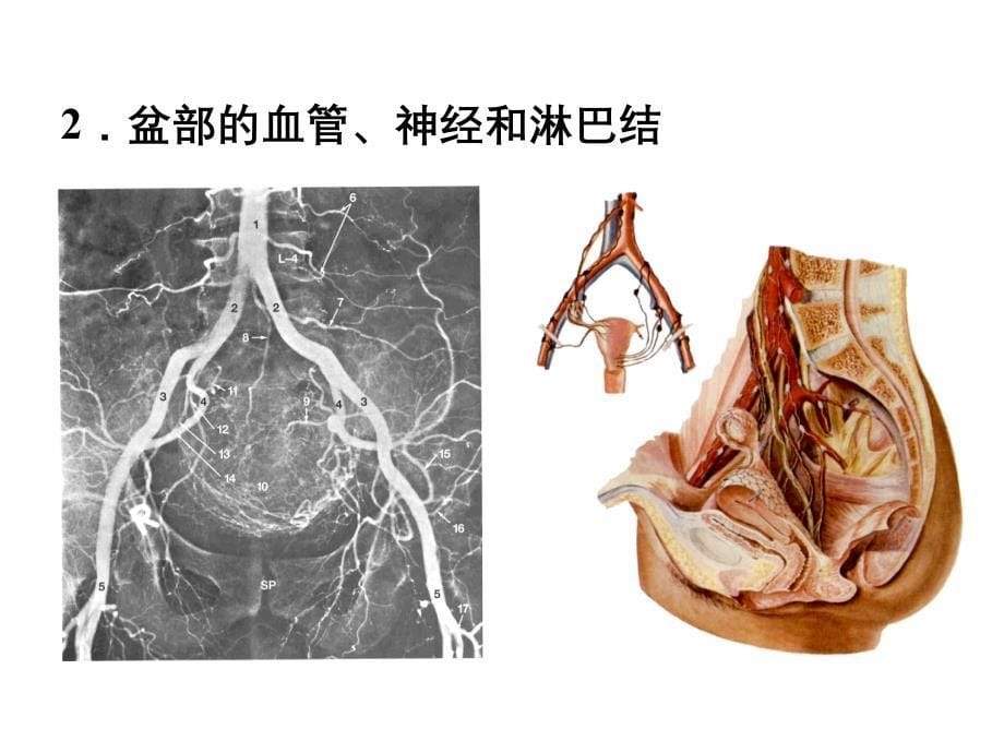 断层解剖学盆部及会阴_第5页