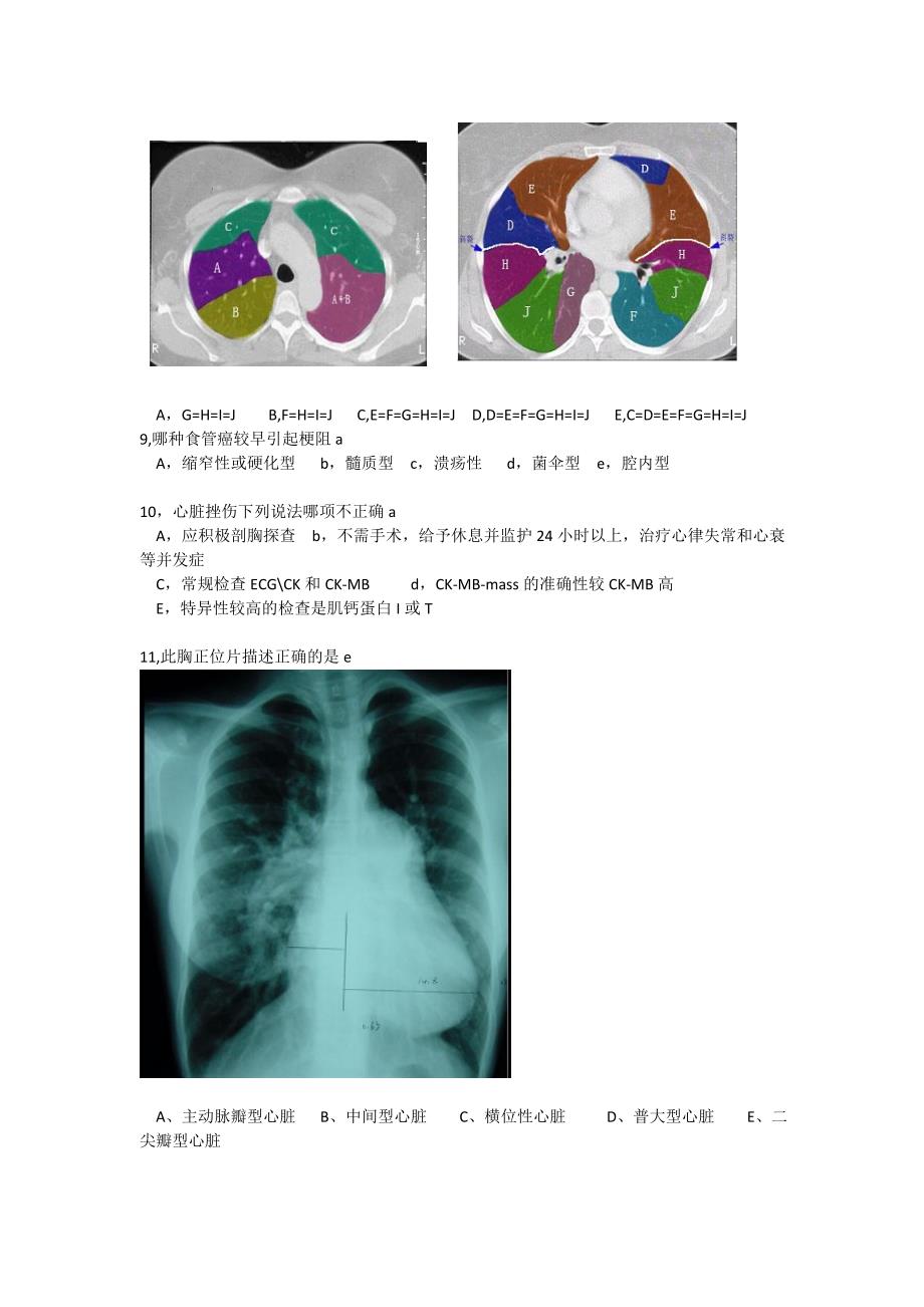 医学专题：胸外科单选题1_第2页