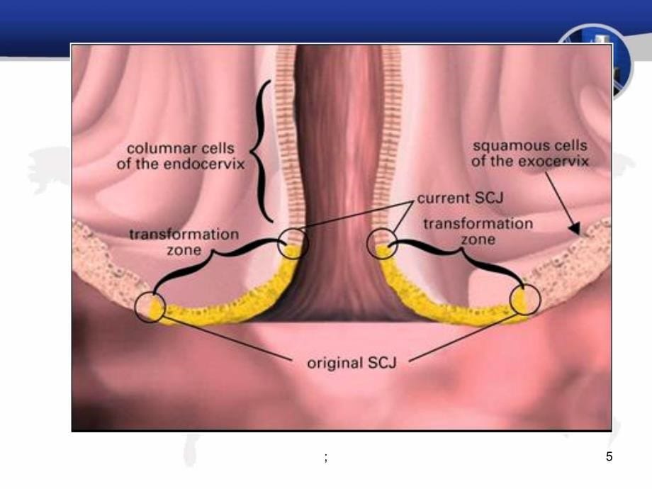 病理学女性生殖系统和乳腺疾病ppt课件_第5页