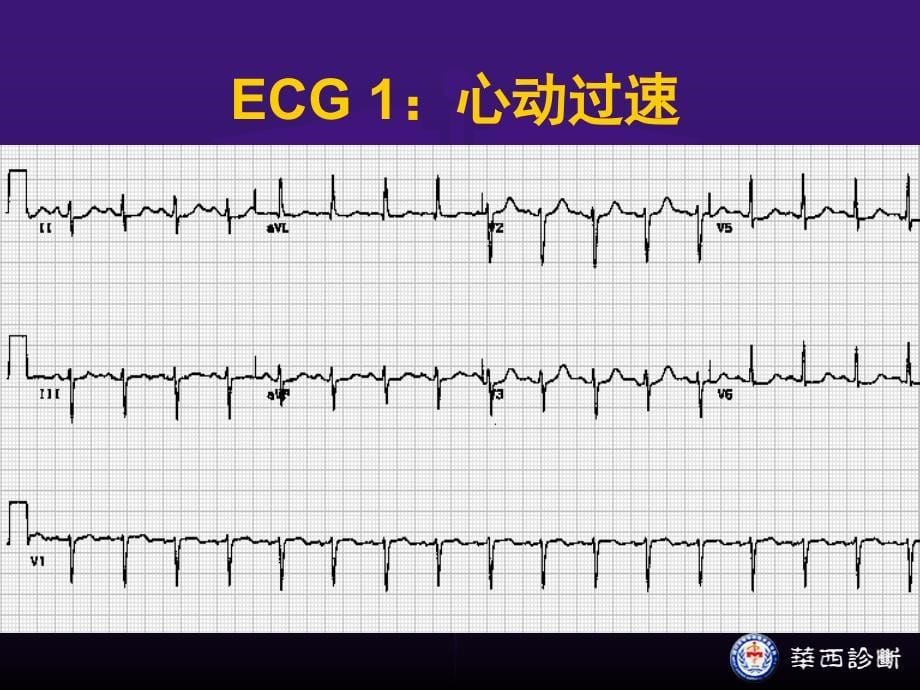 心脏疾病症状学名师编辑PPT课件_第5页