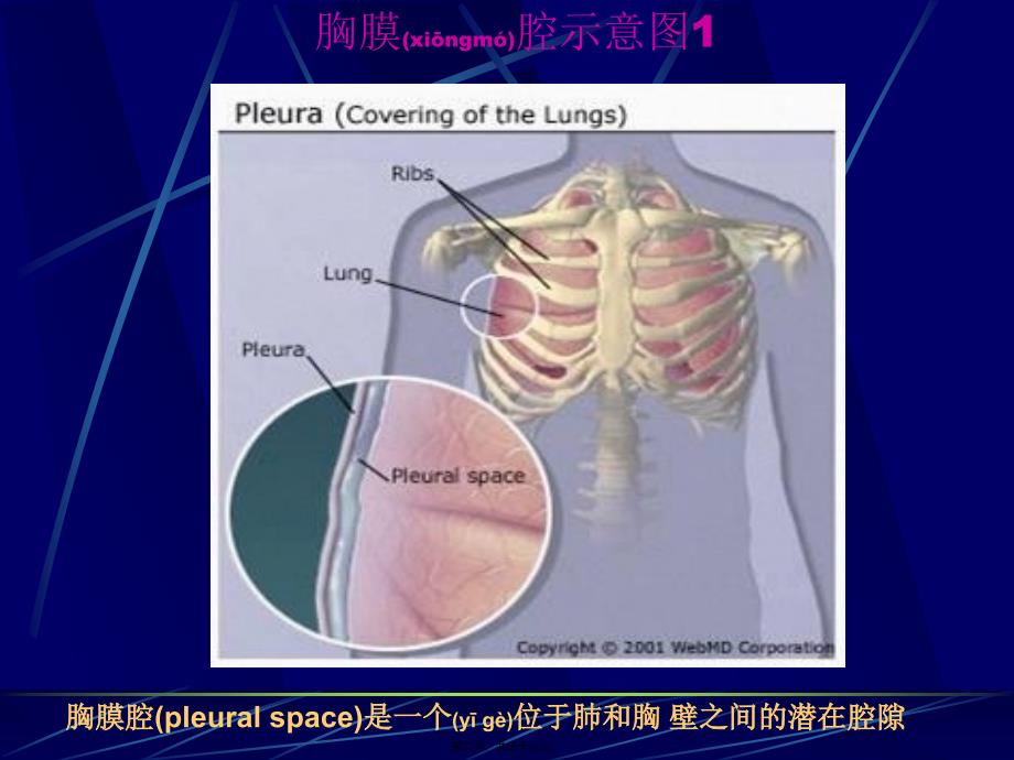 医学专题—胸腔积液(第六版)_第2页