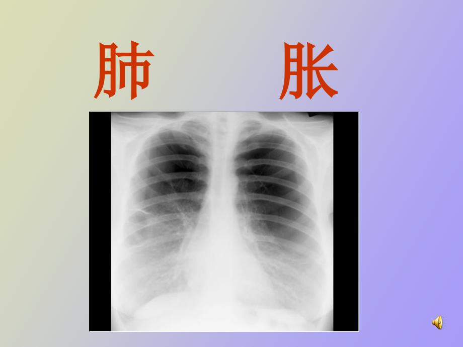 肺胀学习提纲_第1页