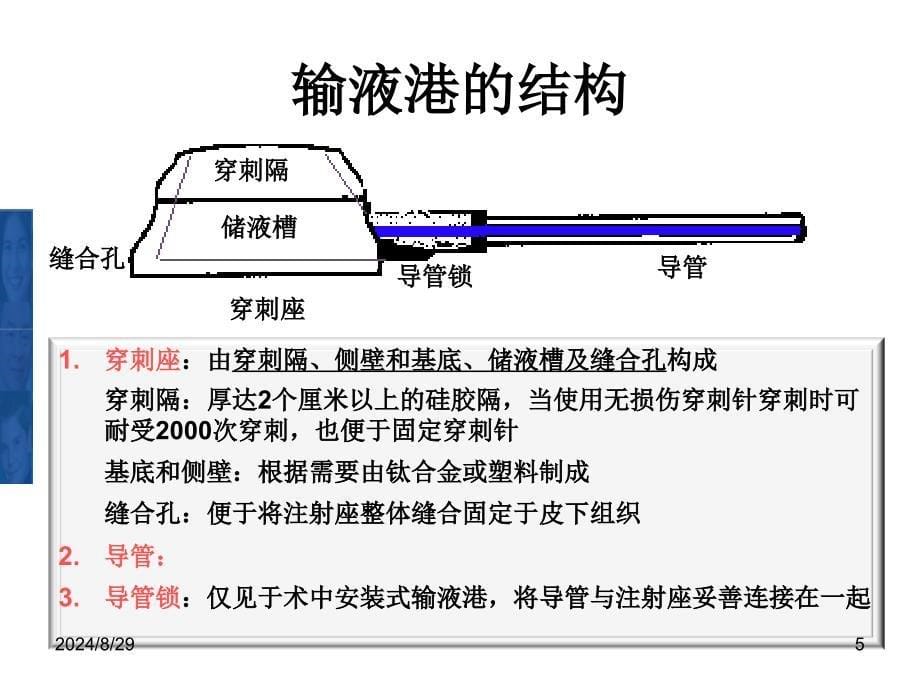 完全植入式中心静脉输液港临床应用与管理_第5页