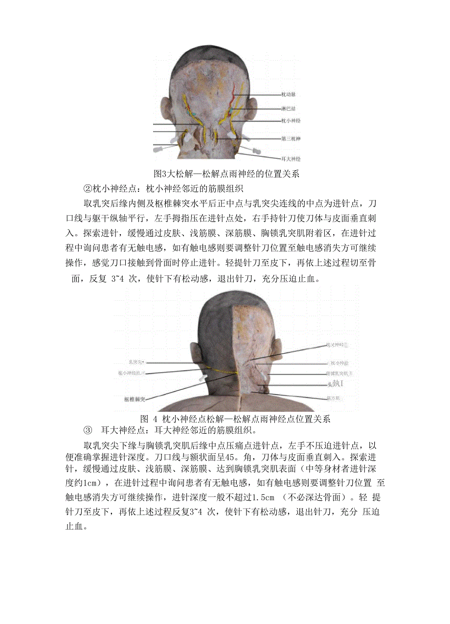 头痛(颈源性头痛)中医诊疗方案_第4页