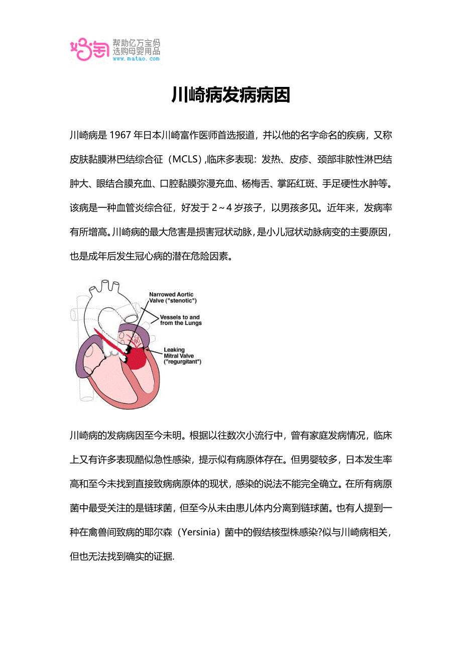 川崎病发病病因.doc_第1页