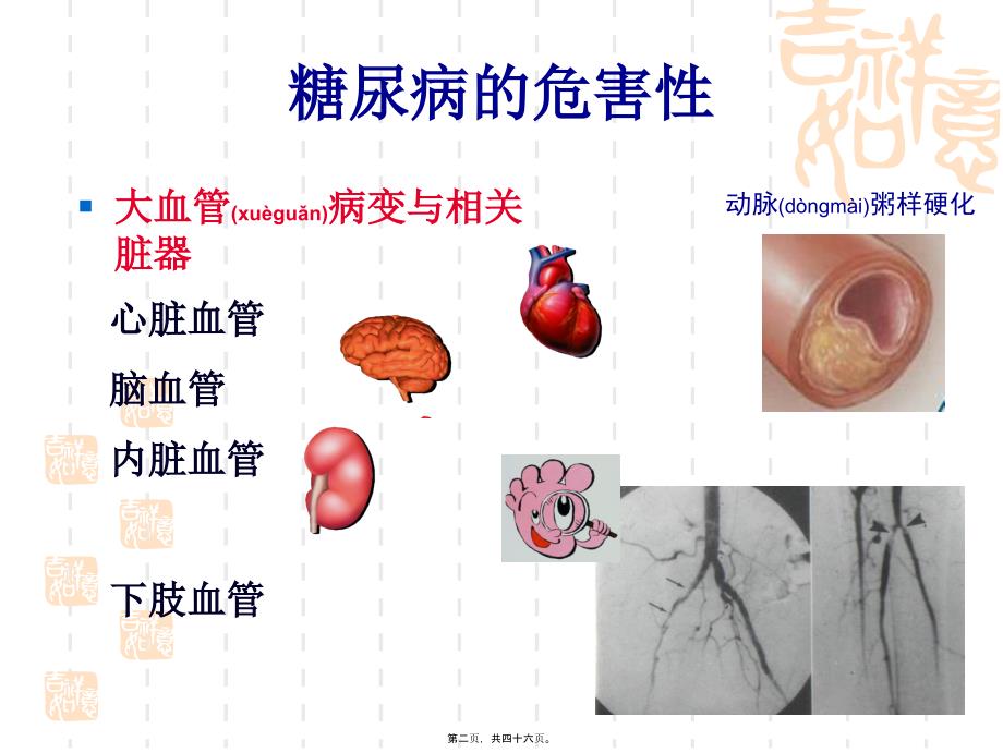 医学专题—糖尿病综合-围手术_第2页