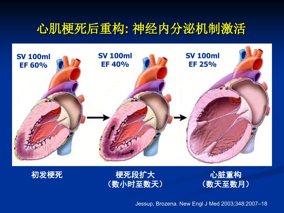 最新“中国慢性心力衰竭诊断治疗指南”解读PPT课件PPT文档_第3页