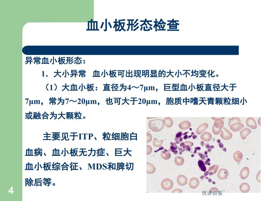 (四)血小板计数【春苗教育】_第4页