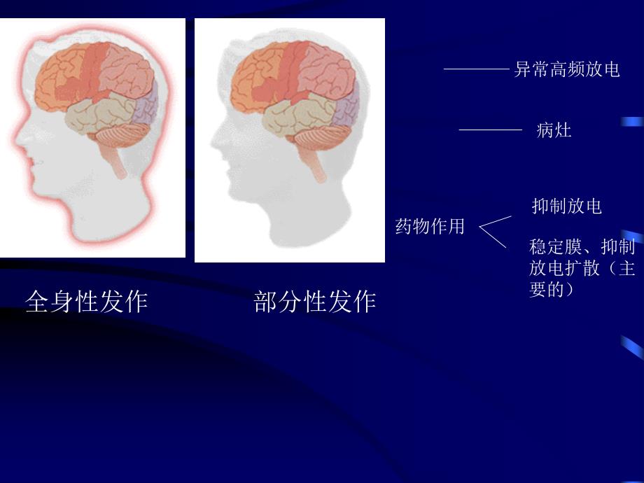 临本第16章抗癫痫药和抗惊厥药_第3页