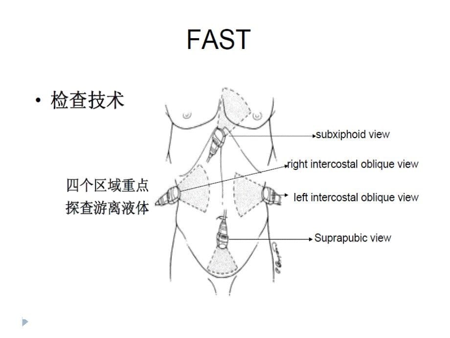 急诊床旁超声的应用详解_第5页