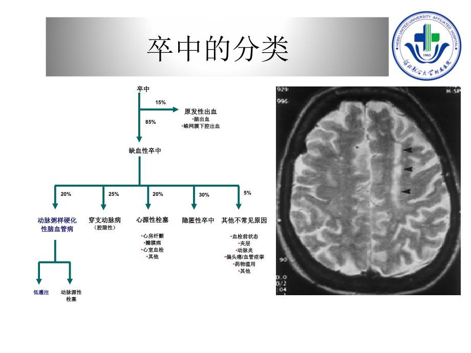 急性进展性卒中的诊治_第4页