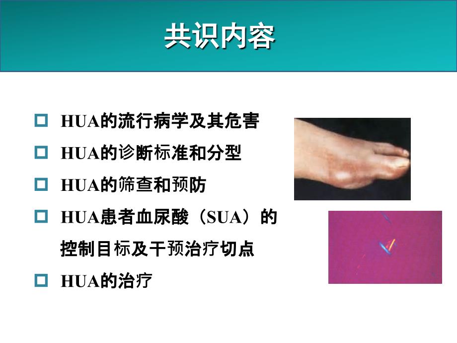 高尿酸血症和痛风治疗中国专家共识课件_第4页