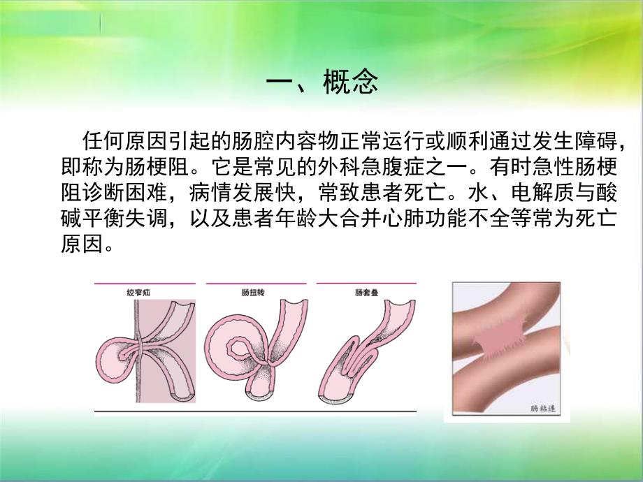 肠梗阻护理常规PPT通用课件_第2页