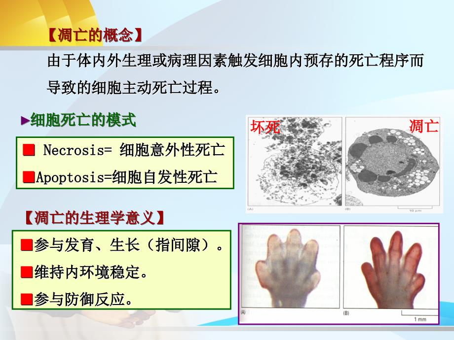 细胞凋亡与疾病_第2页