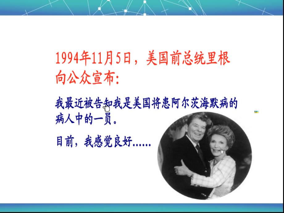 阿尔海默茨氏综合症(老年性痴呆).ppt_第3页