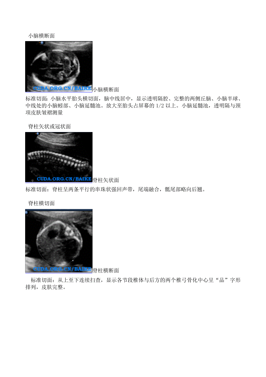 中孕期检查与切面.doc_第3页