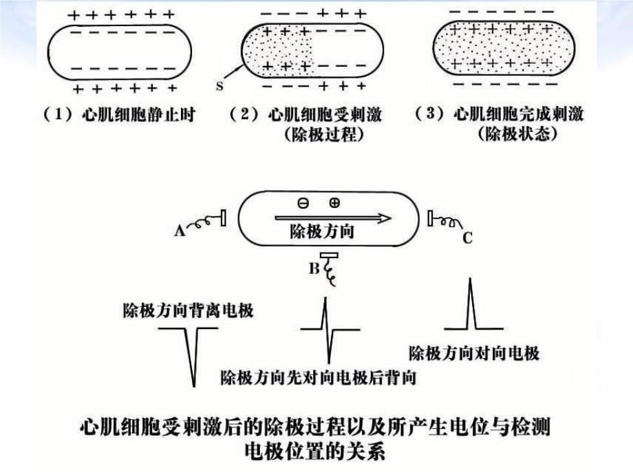 心电图基本知识PPT课件_第5页